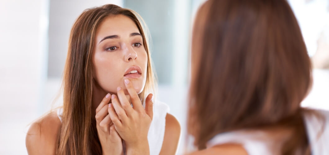 Tratamentos Contra o Acne